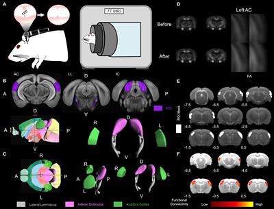 Conductive hearing loss CHL List of Frontiers open access